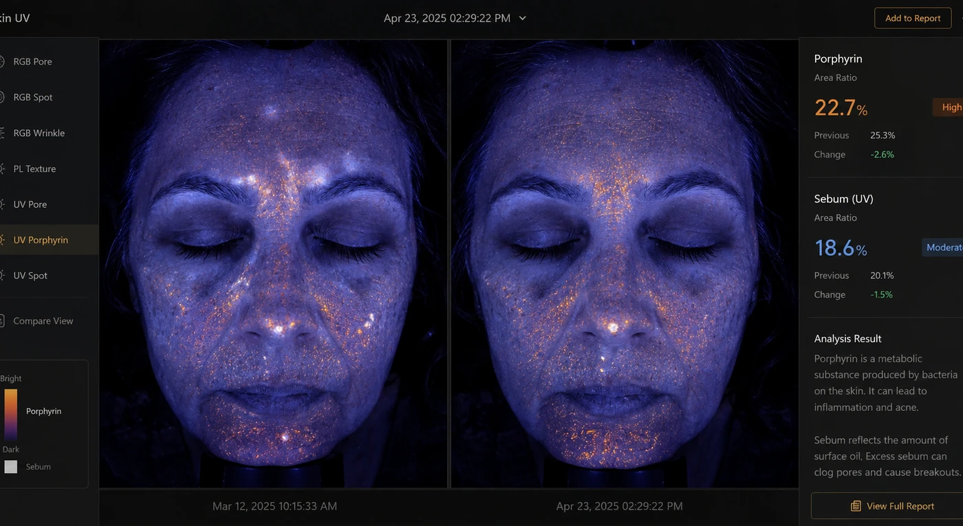 Advanced skin imaging showing pigmentation beneath the surface of the skin