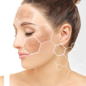 HydraFacial vs. Chemical Peel: Which Treatment Is Right for You?