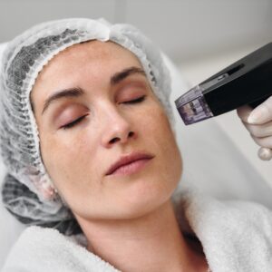 Medical-Grade Acne Treatments: How a Med Spa Can Help Clear Stubborn Breakouts