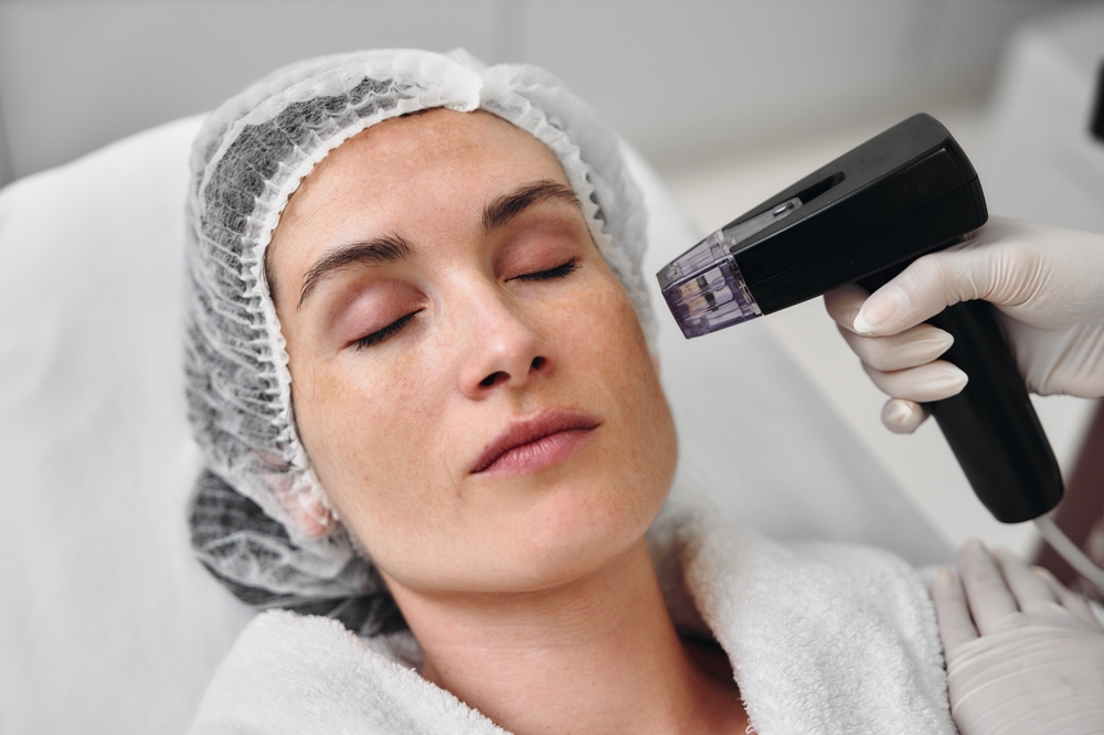 Microneedling 101: Everything You Need to Know About Collagen Induction Therapy