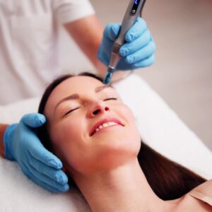 Cost & Value: Is PRF Microneedling Worth It for Acne Scars?
