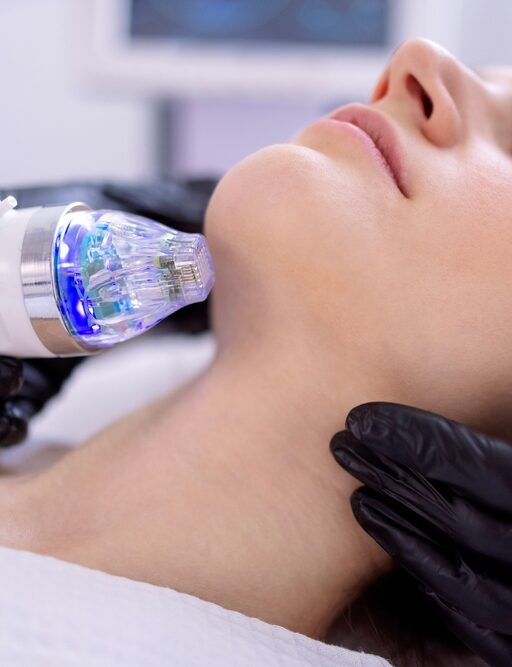 Microneedling Downtime, Side Effects, and Aftercare: A Week-by-Week Guide