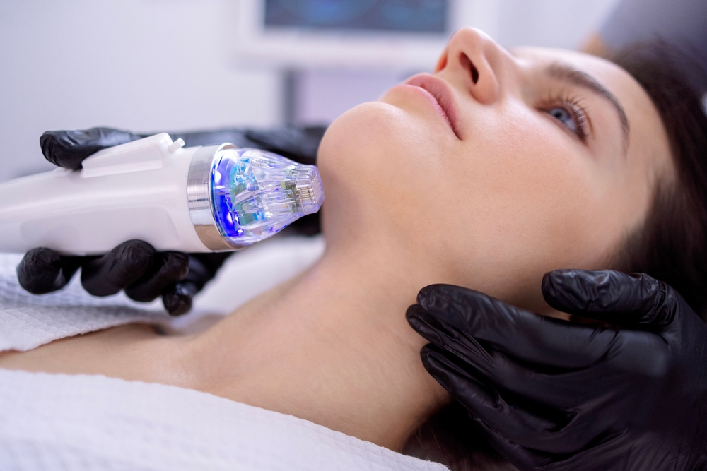 Microneedling Downtime, Side Effects, and Aftercare: A Week-by-Week Guide