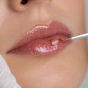 Chemical Peel for Hands – Restore Youthful, Radiant Skin at Iriya Wellness & Aesthetics