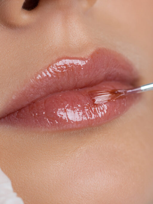 Chemical Peel for Lips: Benefits, Process, Recovery, Results & Where to Get It Done Safely