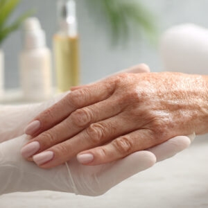 Chemical Peel for Lips: Benefits, Process, Recovery, Results & Where to Get It Done Safely