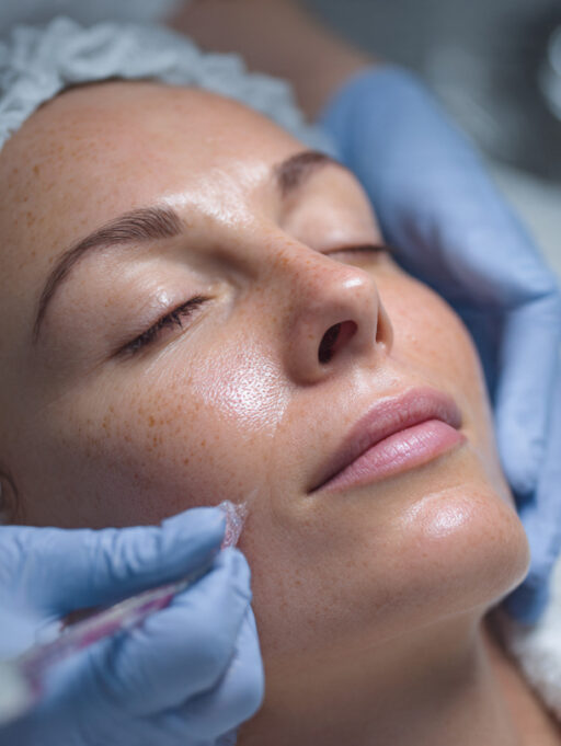 Chemical Peel for Pimples: Benefits, Types, Procedure, and What to Expect